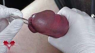 Perfect extraction of sperm directly from the urethra. Close-up of the glass straw sounding.